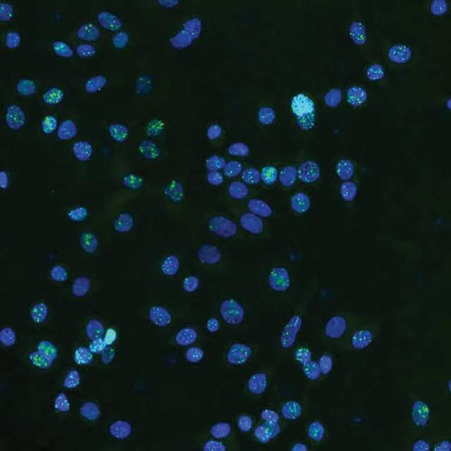 人工智能发现了隐藏在“垃圾”DNA中的癌症驱动因素(图2)